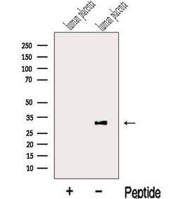 Invitrogen LETM2 Polyclonal Antibody 100 &mu;L | Buy Online | Invitrogen&trade; | Fisher Scientific