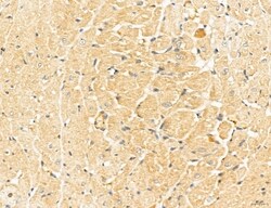 Invitrogen LOH12CR1 Polyclonal Antibody 100 &mu;L; Unconjugated:Antibodies,
