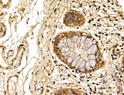 Invitrogen LOH12CR1 Polyclonal Antibody 100 &mu;L; Unconjugated:Antibodies,