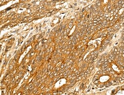 Invitrogen LOH12CR1 Polyclonal Antibody 100 &mu;L; Unconjugated:Antibodies,