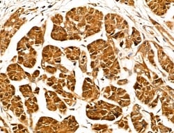 Invitrogen LOH12CR1 Polyclonal Antibody 100 &mu;L; Unconjugated:Antibodies,