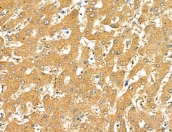 Invitrogen LOH12CR1 Polyclonal Antibody 100 &mu;L; Unconjugated:Antibodies,