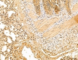 Invitrogen LOH12CR1 Polyclonal Antibody 100 &mu;L; Unconjugated:Antibodies,