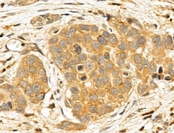 Invitrogen LOH12CR1 Polyclonal Antibody 100 &mu;L; Unconjugated:Antibodies,