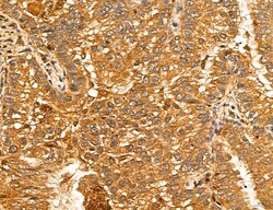 Invitrogen LOH12CR1 Polyclonal Antibody 100 &mu;L; Unconjugated:Antibodies,