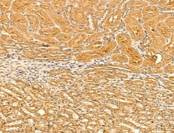 Invitrogen LOH12CR1 Polyclonal Antibody 100 &mu;L; Unconjugated:Antibodies,