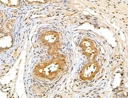 Invitrogen LOH12CR1 Polyclonal Antibody 100 &mu;L; Unconjugated:Antibodies,