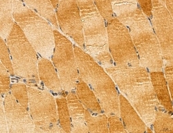 Invitrogen LOH12CR1 Polyclonal Antibody 100 &mu;L; Unconjugated:Antibodies,