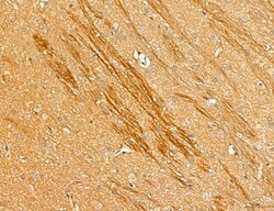 Invitrogen LOH12CR1 Polyclonal Antibody 100 &mu;L; Unconjugated:Antibodies,