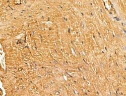 Invitrogen LOH12CR1 Polyclonal Antibody 100 &mu;L; Unconjugated:Antibodies,