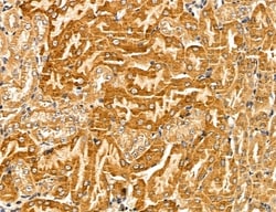 Invitrogen LOH12CR1 Polyclonal Antibody 100 &mu;L; Unconjugated:Antibodies,