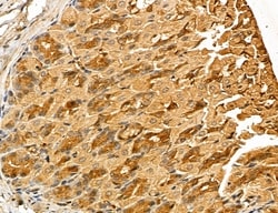 Invitrogen LOH12CR1 Polyclonal Antibody 100 &mu;L; Unconjugated:Antibodies,