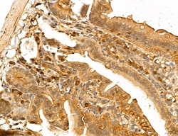 Invitrogen LOH12CR1 Polyclonal Antibody 100 &mu;L; Unconjugated:Antibodies,