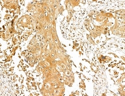 Invitrogen LOH12CR1 Polyclonal Antibody 100 &mu;L; Unconjugated:Antibodies,