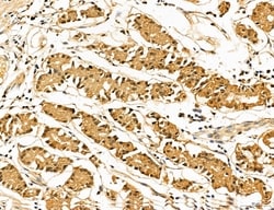Invitrogen LOH12CR1 Polyclonal Antibody 100 &mu;L; Unconjugated:Antibodies,