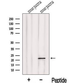 Invitrogen LOH12CR1 Polyclonal Antibody 100 &mu;L; Unconjugated:Antibodies,