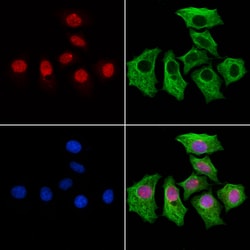 Invitrogen MED10 Polyclonal Antibody 100 &mu;L; Unconjugated:Antibodies,