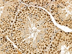 Invitrogen MED10 Polyclonal Antibody 100 &mu;L; Unconjugated:Antibodies,