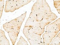 Invitrogen MED10 Polyclonal Antibody 100 &mu;L; Unconjugated:Antibodies,