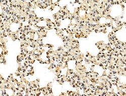 Invitrogen MED10 Polyclonal Antibody 100 &mu;L; Unconjugated:Antibodies,