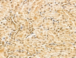 Invitrogen MED10 Polyclonal Antibody 100 &mu;L; Unconjugated:Antibodies,