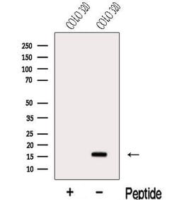 Invitrogen MED10 Polyclonal Antibody 100 &mu;L; Unconjugated:Antibodies,