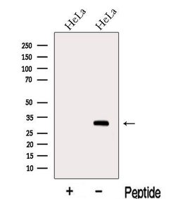 Invitrogen METTL6 Polyclonal Antibody 100 &mu;L; Unconjugated:Antibodies,