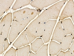 Invitrogen RKHD2 Polyclonal Antibody 100 &mu;L | Buy Online | Invitrogen&trade; | Fisher Scientific