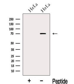 Invitrogen RKHD2 Polyclonal Antibody 100 &mu;L | Buy Online | Invitrogen&trade; | Fisher Scientific