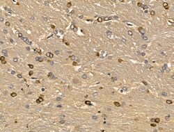 Invitrogen MGAT5B Polyclonal Antibody 100 &mu;L; Unconjugated:Antibodies,
