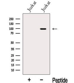 Invitrogen MGAT5B Polyclonal Antibody 100 &mu;L; Unconjugated:Antibodies,