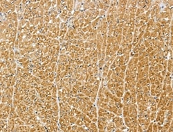 Invitrogen MIPEP Polyclonal Antibody 100 &mu;L | Buy Online | Invitrogen&trade; | Fisher Scientific