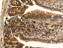 Invitrogen MLK2 Polyclonal Antibody 100 &mu;L; Unconjugated:Antibodies,