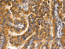 Invitrogen MLK2 Polyclonal Antibody 100 &mu;L; Unconjugated:Antibodies,