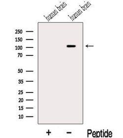 Invitrogen MLK2 Polyclonal Antibody 100 &mu;L; Unconjugated:Antibodies,