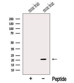 MOBP Polyclonal Antibody:Antibodies, Polyclonal