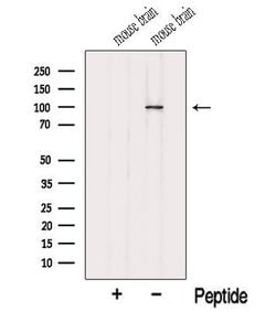 Invitrogen MYO1D Polyclonal Antibody 100 &mu;L; Unconjugated:Antibodies,