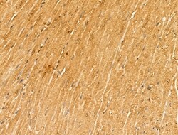 Invitrogen MYOM1 Polyclonal Antibody 100 &mu;L; Unconjugated:Antibodies,