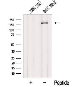 Invitrogen MYOM1 Polyclonal Antibody 100 &mu;L; Unconjugated:Antibodies,