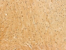 Invitrogen MYOM3 Polyclonal Antibody 100 &mu;L; Unconjugated:Antibodies,