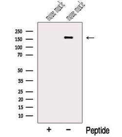 Invitrogen MYOM3 Polyclonal Antibody 100 &mu;L; Unconjugated:Antibodies,
