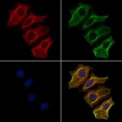 Invitrogen Myotilin Polyclonal Antibody 100 &mu;L; Unconjugated:Antibodies,
