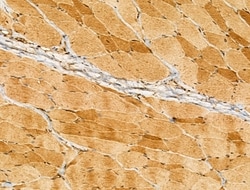 Invitrogen Myotilin Polyclonal Antibody 100 &mu;L; Unconjugated:Antibodies,