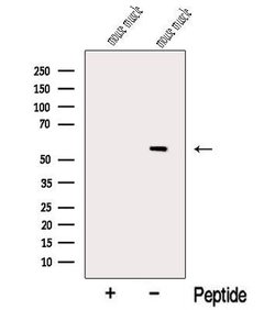 Invitrogen Myotilin Polyclonal Antibody 100 &mu;L; Unconjugated:Antibodies,