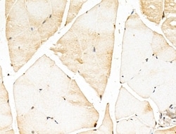 Invitrogen MYOZ2 Polyclonal Antibody 100 &mu;L; Unconjugated:Antibodies,