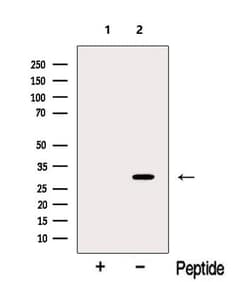 Invitrogen MYOZ2 Polyclonal Antibody 100 &mu;L; Unconjugated:Antibodies,