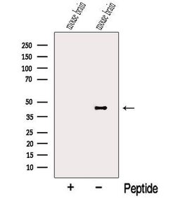 Invitrogen NECAB2 Polyclonal Antibody 100 &mu;L; Unconjugated:Antibodies,