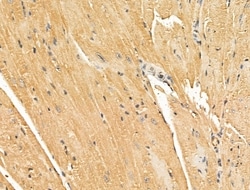 Invitrogen NECAP1 Polyclonal Antibody 100 &mu;L; Unconjugated:Antibodies,