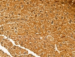 Invitrogen NECAP1 Polyclonal Antibody 100 &mu;L; Unconjugated:Antibodies,