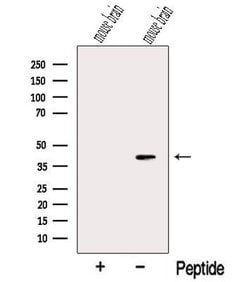Invitrogen NECAP1 Polyclonal Antibody 100 &mu;L; Unconjugated:Antibodies,